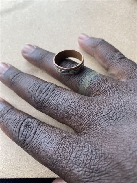 copper ring turns finger green.